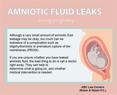 can amniotic fluid leak and then stop|Leaking Amniotic Fluid: How to Tell